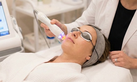 One Session - Radio Frequency Skin Tightening (Full Face) - You by Paris