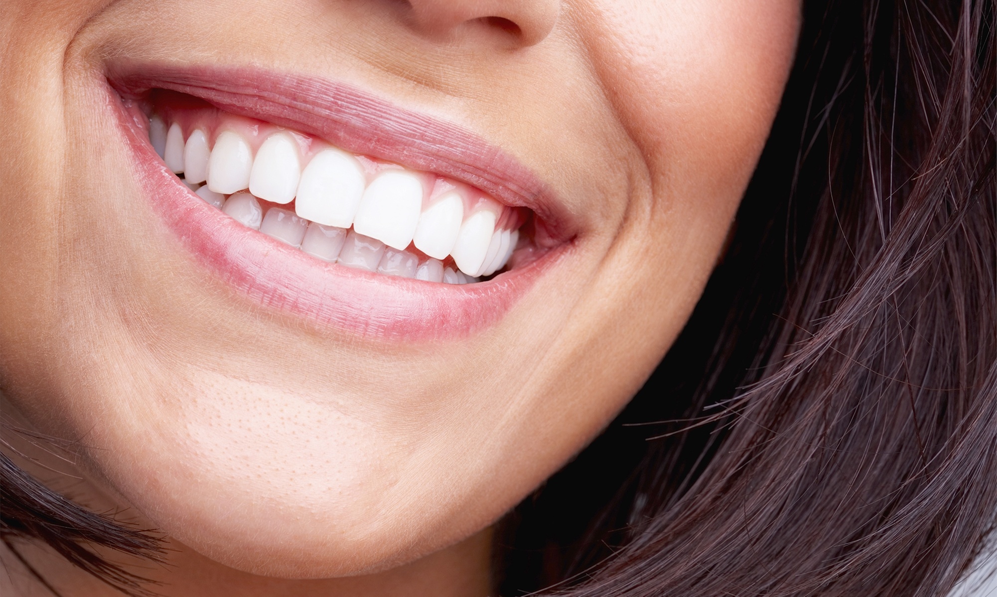 Brighten Your Smile with One Express Whitening Treatment