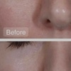 Image 3: Choice of Facial- Classic, Microdermabrasion, or More 