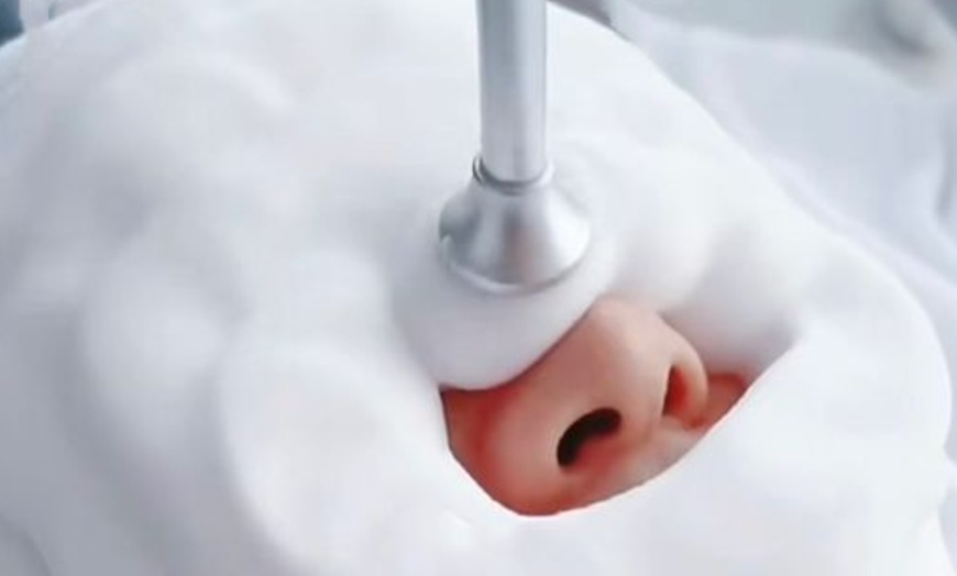 Image 1: No Pain, All Glow: The Deep-Clean Facial Your Pores Need