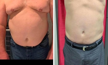 Two Non-Invasive Laser-Lipo Treatments with 640 Laser - Perfections Body Sculpt