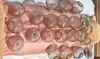 Acupuncture and Oriental Medicine Clinic Offers Fire Cupping or Air Compression Therapies (Up to 30% Off)