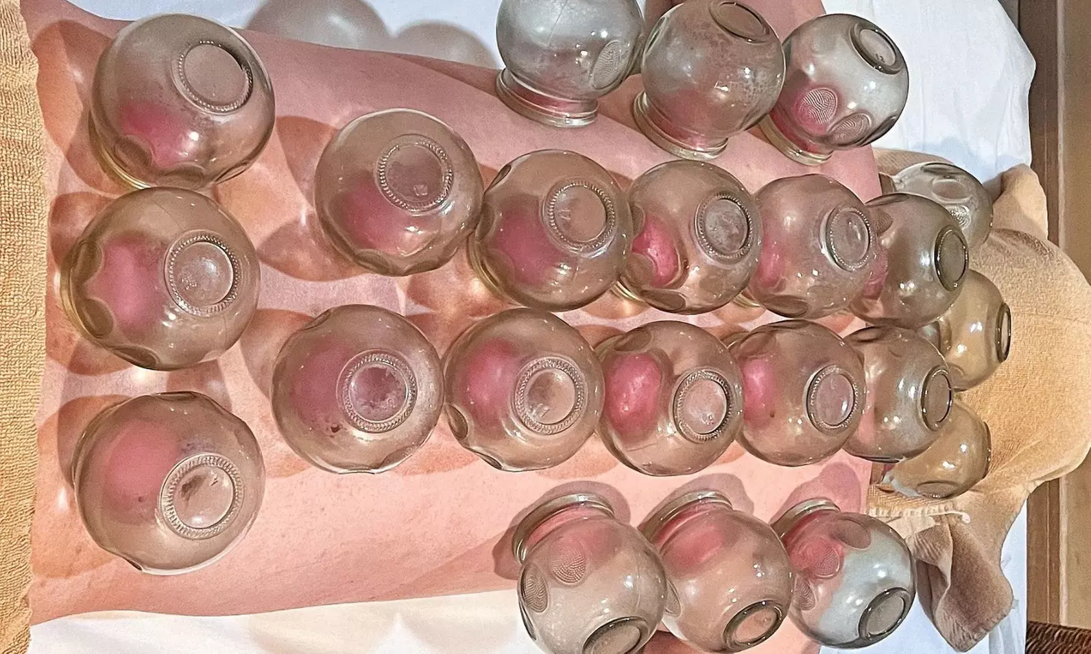 Acupuncture and Oriental Medicine Clinic Offers Fire Cupping or Air Compression Therapies (Up to 30% Off) - Primary Image