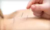 One or Three Acupuncture Sessions at Stillpoint Community Acupuncture (Up to 52% Off)