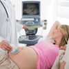 Image 4: Up to 40% Off on Early Pregnancy, Reassurance, and Gender Ultrasounds