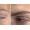 Image 4: Sesión de microblading de cejas pelo a pelo con opción a retoque 