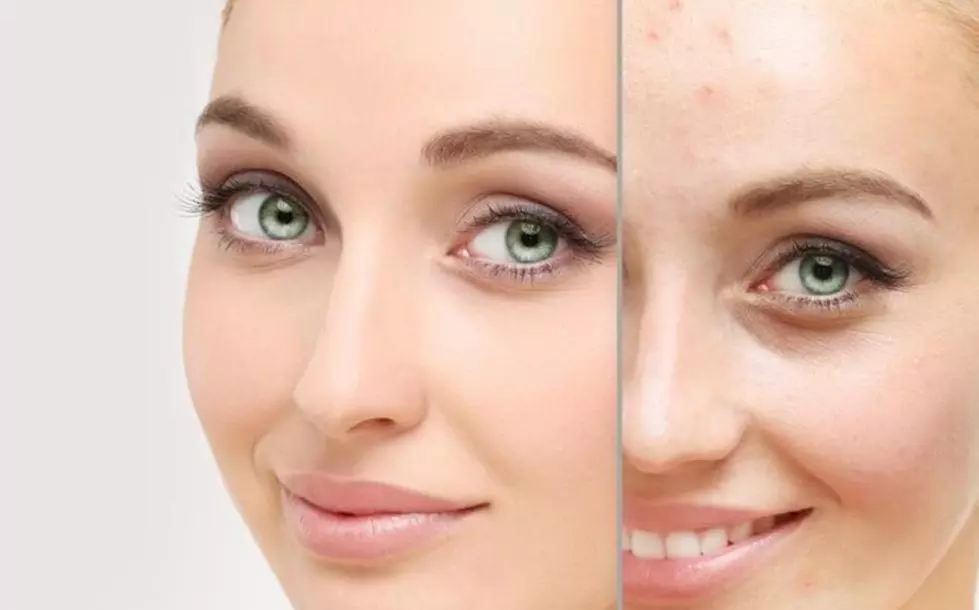 Strahlende Haut mit Microneedling, BB-Glow oder Aqua-Facial