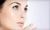 $30 for a European Classic Facial at Endless Summer Salon LLC ($60 Value)