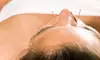 Consultation and Acupuncture with Dr. Behzad Azargoshasb, Naturopathic Doctor at Horizon Wellness (Up 81% Off) 