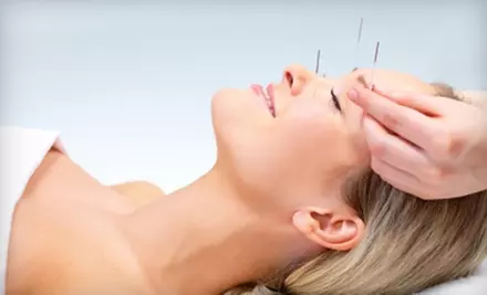 Acupuncture Treatment at Cloud 9 Acupuncture Community Clinic in Temperance. Choose Between Two Options. - Primary Image