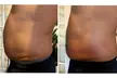 One, Three, or Six 60-Min Lipo-Cavitation and Radiofrequency Session At Taylor’d Physique (Up to 60% Off) - Second Medium