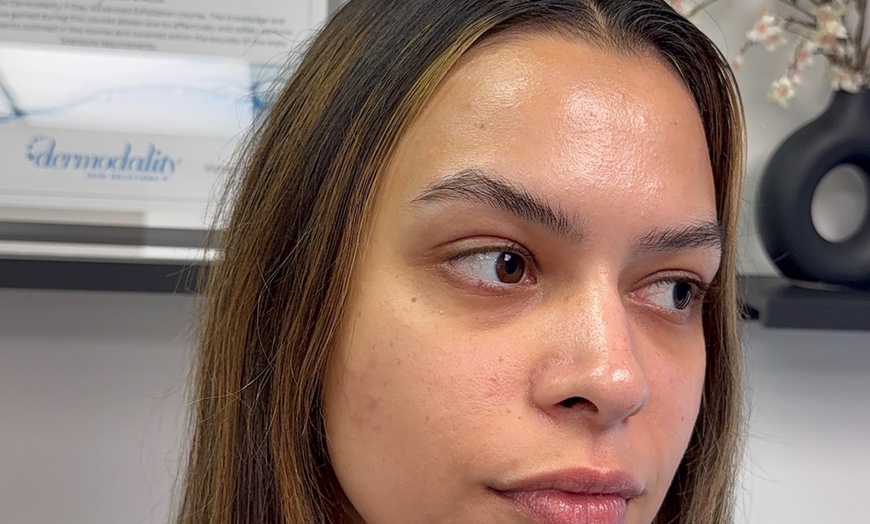 Image 2: Custom & Dermaplane Facial Services for Refreshed, Radiant Skin