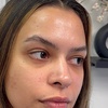 Image 2: Custom & Dermaplane Facial Services for Refreshed, Radiant Skin