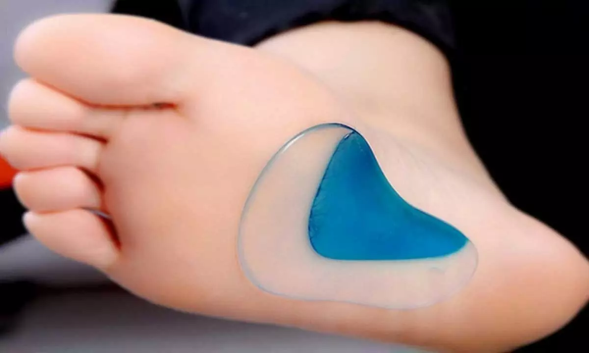 1, 2 oder 4 Paar orthopädische Gel-Einlagen für Fußgewölbe - Primary Image