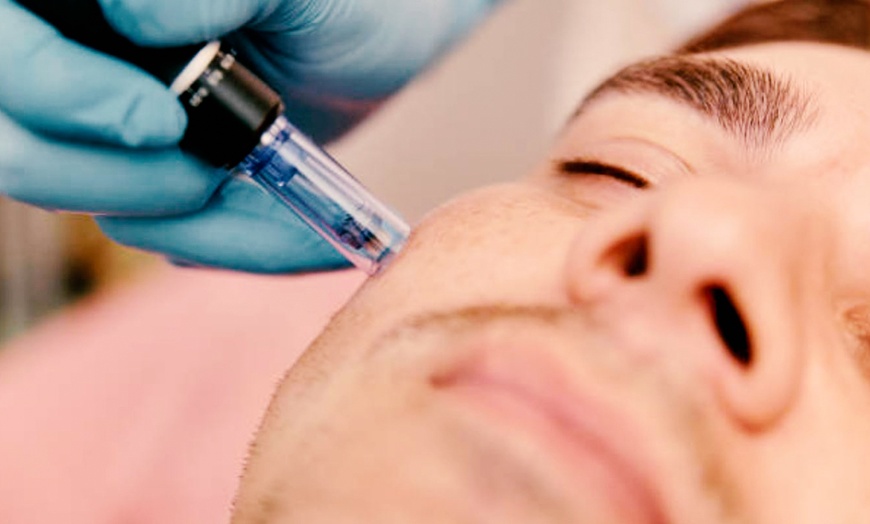 Image 11: Limpieza facial con tratamiento antiarrugas, hydralips, relleno y más