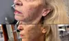 Transform Your Look with 20, 40, 60 Units of Letybo or 1 Syringe of Juvederm Ultra XC (1.0mL) (Up to 38% Off)
