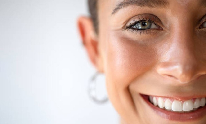 Image 17: 1 o 2 sesiones de rehidratación de labios o microlifting facial para 1