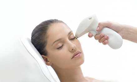 Six Laser Hair Removal Session For One Small Area - BodyBrite - Cooper City
