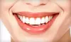 Dental Care Package with Cleaning, X-Rays, and Polishing at Downtown Dental Studio. Whitening Kit Upgrade Also Available (Up to 90% Off). 