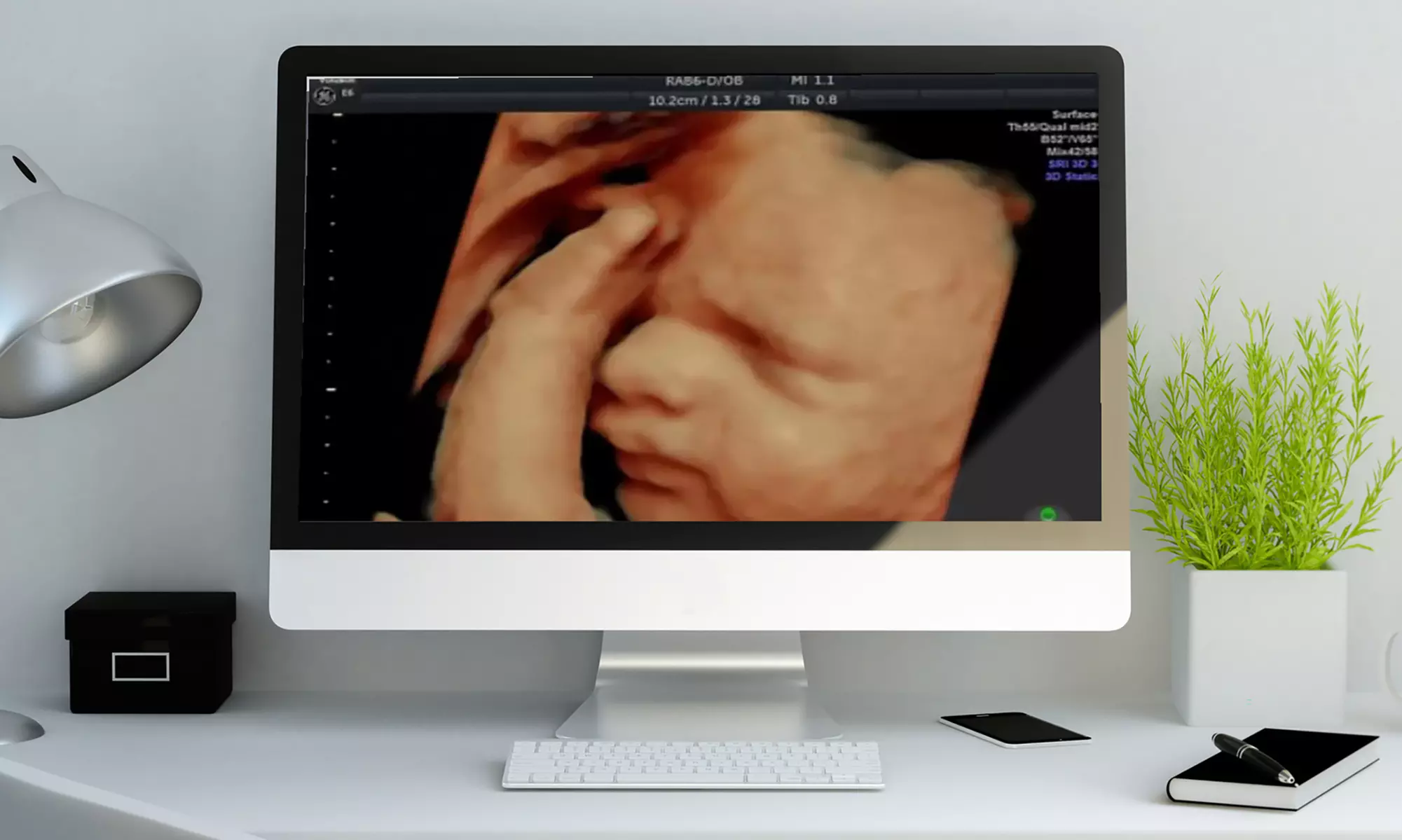Embrace Precious Prenatal Moments with 3D/4D or Heartbeat Sneak Peek 