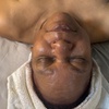 Image 5: Relax with 60-Min TreaLuke Back + 80-Min Diamond Facial (1–3 Sessions)