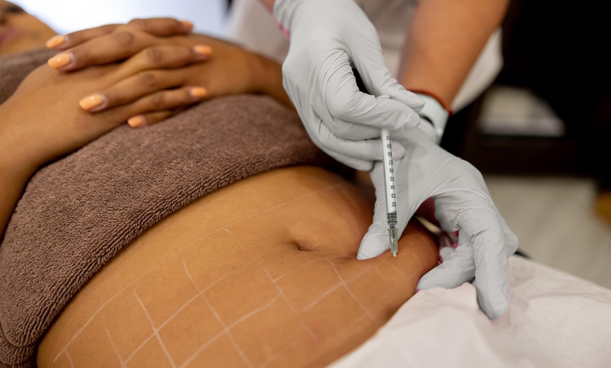 Image 1: Up to 55% Off on Fat Reduction - Non-Branded at Body Radiance Med Spa