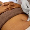 Image 1: Up to 55% Off on Fat Reduction - Non-Branded at Body Radiance Med Spa