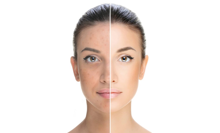 Image 2: Revitalize Your Skin with One, Two or Three 90-Minute Beauty Sessions 