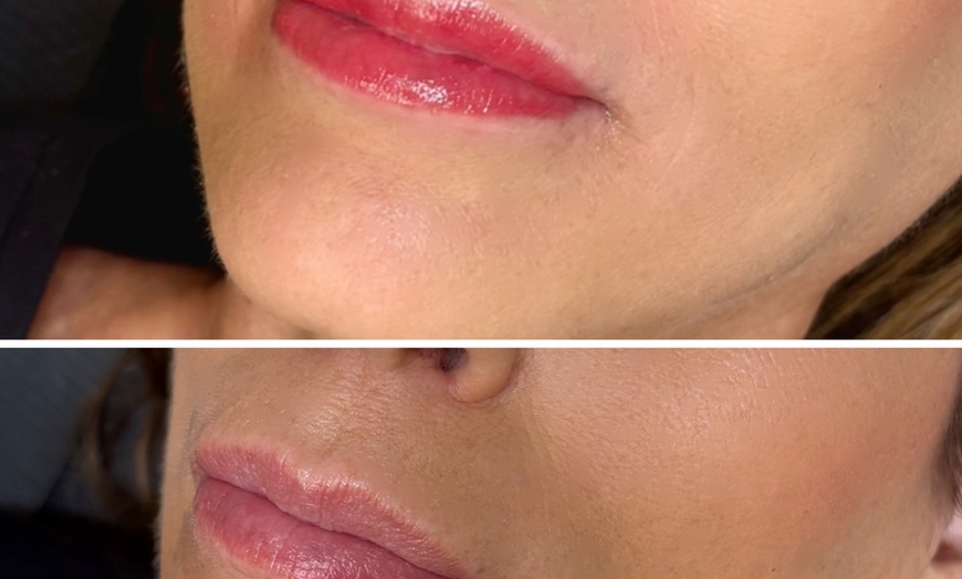Image 4: Lip Blush Tattoo and Touchup Included for a Natural Lip Enhancement
