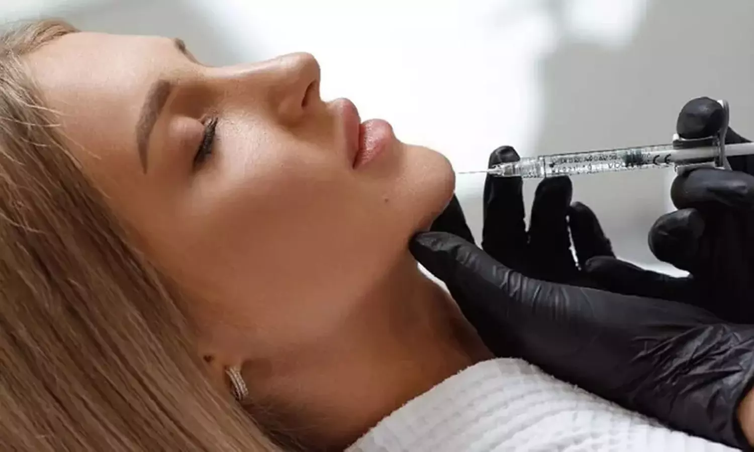 Relleno dérmico facial con 1, 2 o 3 viales en zona a elegir