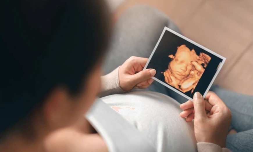 Image 5: Ecografía 5D de tu bebé con opción a foto impresa y audio del latido