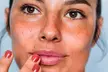 Enjoy June Skin's Unlimited Xeomin Units for the Full Face Valid Every Sunday with Up to 57% Off in Detroit - Second Medium