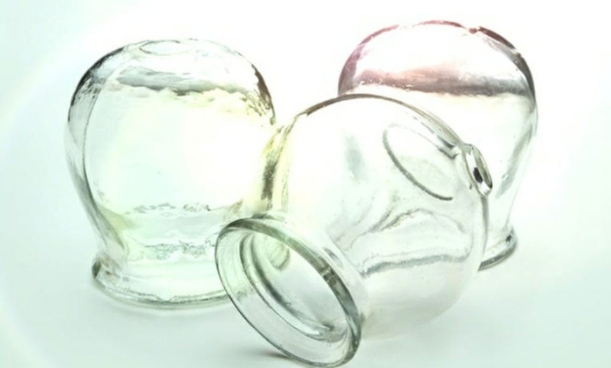 Image 7: 20-Minute 1, 3, or 5 Combination Cupping Sessions: (Wet, Dry & Moving)