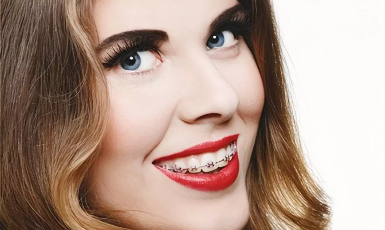 Up to 75% Off on Orthodontist at Ortho London Ltd