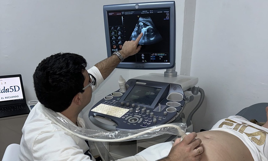 Image 1: Ecografía a elegir dependiendo de la semana de embarazo para 1 persona