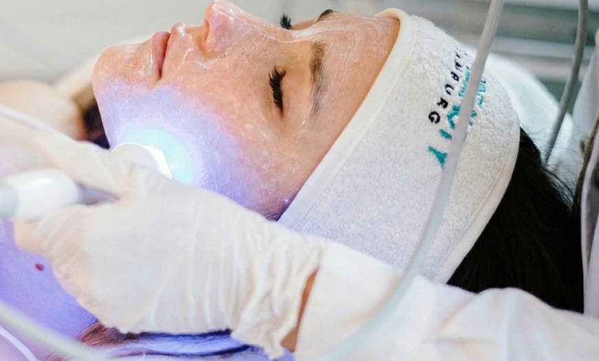 Image 4: 1-3x klassische Gesichtsbehandlung oder Microneedling für 1 Person