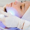Image 4: 1-3x klassische Gesichtsbehandlung oder Microneedling für 1 Person
