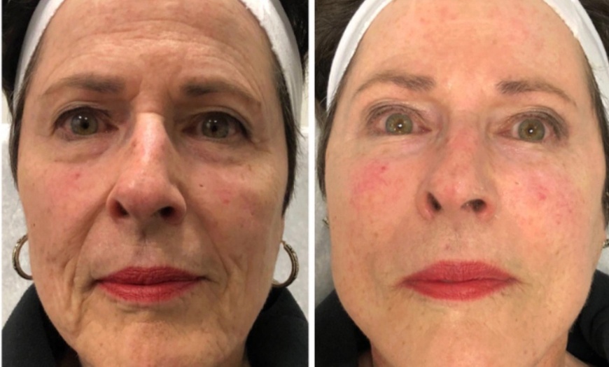 Image 4: Up to 75% Off on Facial - Chosen by Customer at Dream Soaps Spa