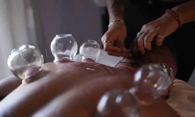 Revitalize With Acupuncture, Cupping, & Facial Rejuvenation Therapy