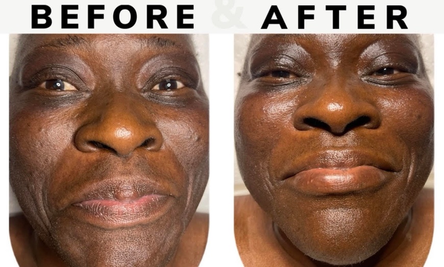 Image 2: Facial, Foot Detox & Massage Packages – Solo or Couples Options 