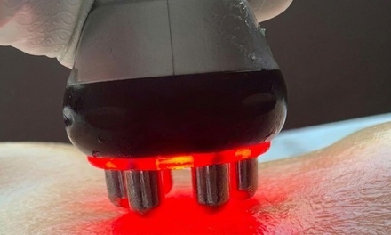 One Skin-Tightening Session for Face or Body - Nova Skulpt