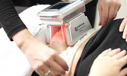 Sur 1 zone au choix : 1 séance de cryo de 40 min. - JFG Clinic Boulogne-billancourt