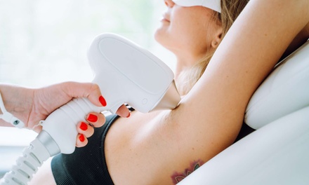 3 Session of Laser Hair Removal on One Body Part - Any Size - 3D Lash And Brow