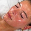 Image 2: Up to 63% Off on Chemical Peel at Allure Passions Aesthetic Clinic