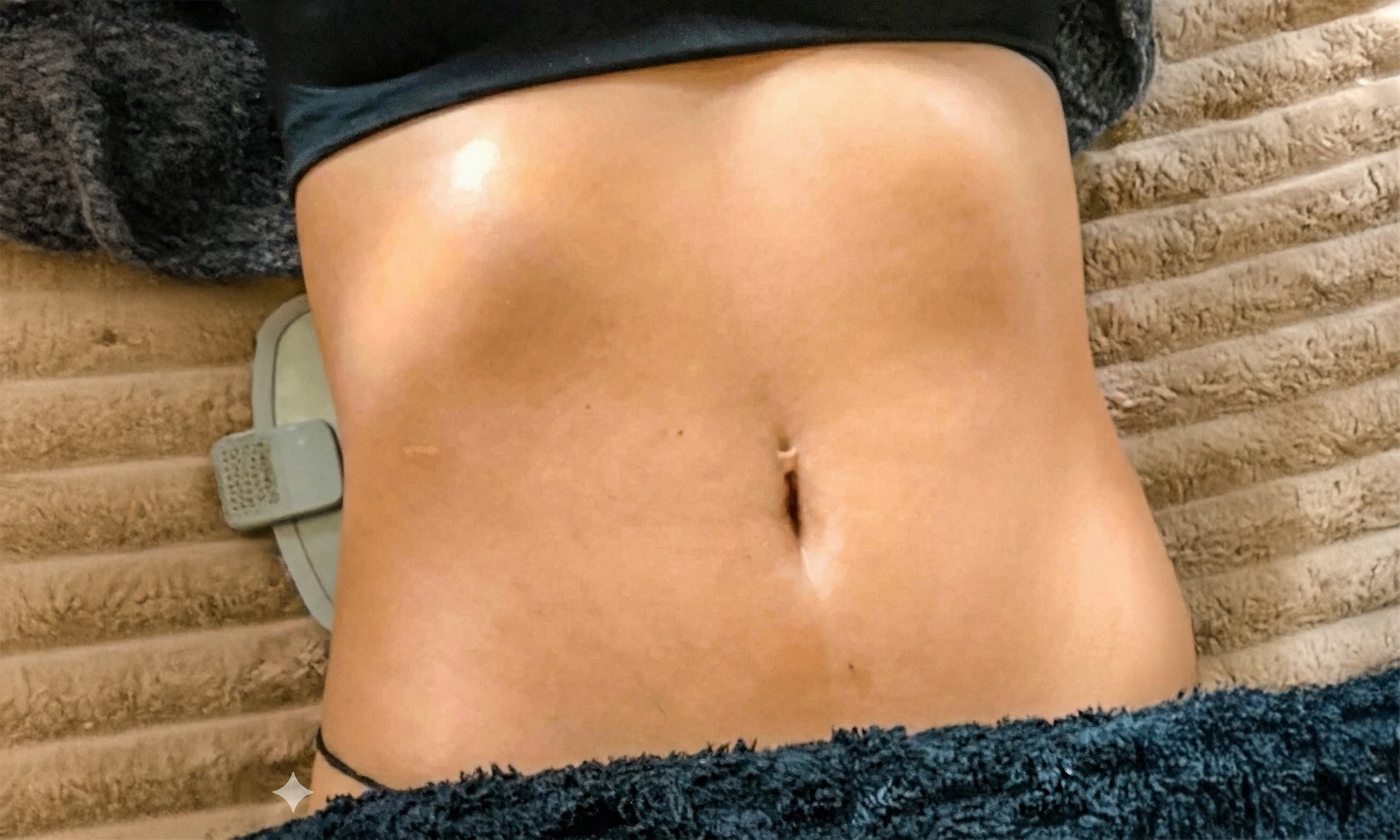 Radiofrecuencia Dual Pro, presoterapia y termoterapia: 2 o 4 sesiones