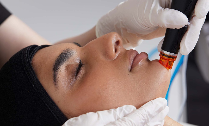 Image 2: Refresh Your Look with Kensington Glow's Signature Hydrafacials