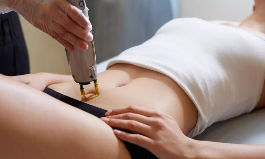 Image 2: Six Sessions of Laser Hair Removal for Small, Medium, or Large Areas 