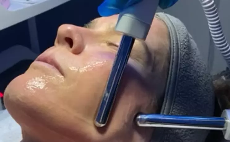 Slim, Sculpt & Glow — CryoSlimming + Cryo Glo Facial at Shape Lounge