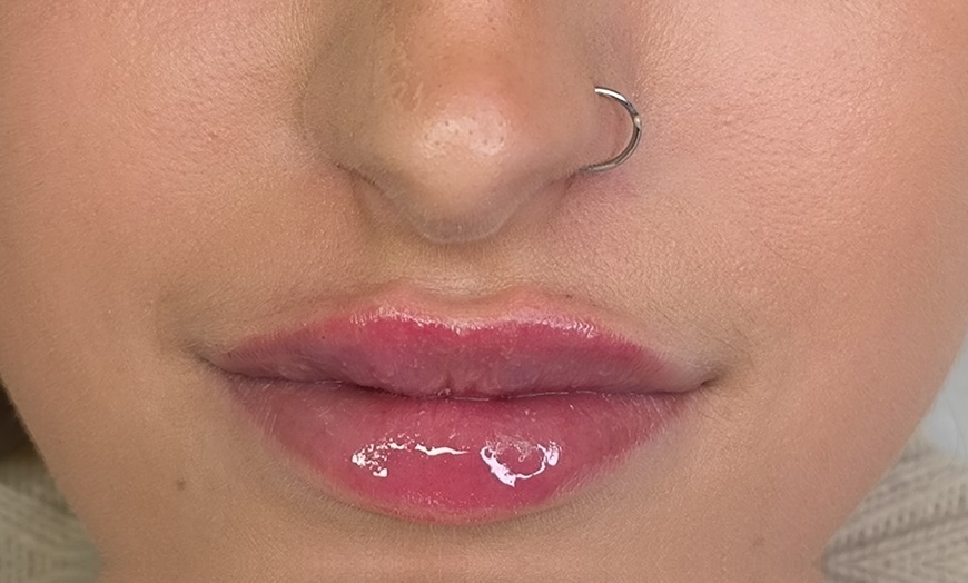 Image 3: Enhance with 0.5ml or 1ml Russian Lip Filler - AdriennVarga Aesthetics