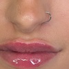 Image 3: Enhance with 0.5ml or 1ml Russian Lip Filler - AdriennVarga Aesthetics
